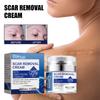 Eelhoe Scar Repair Cream For Reducing Scars And Smoothening Skin With 50ml Capacity