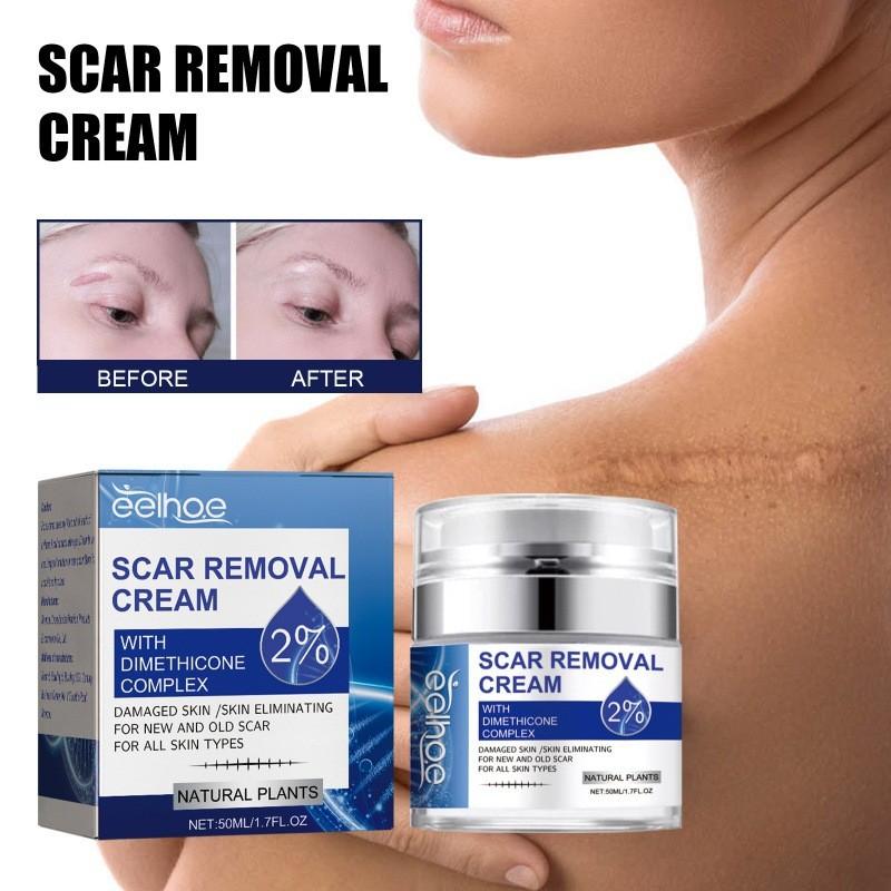 Eelhoe Scar Repair Cream For Reducing Scars And Smoothening Skin With 50ml Capacity