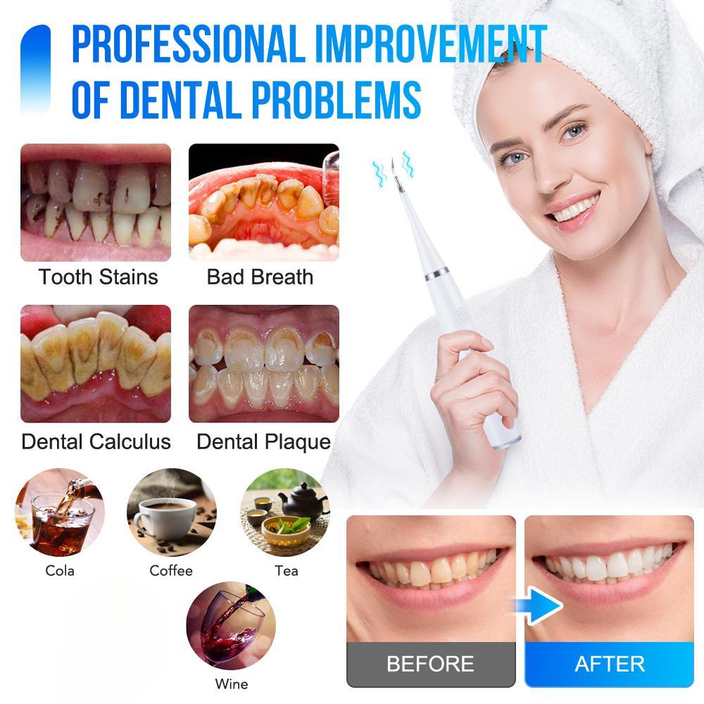 6 In 1 Ultrasonic Dental Cleaner Scaler Dental Tartar Remover Electric Toothbrush Sonic Teeth Plaque Cleaner Tooth Cleaner