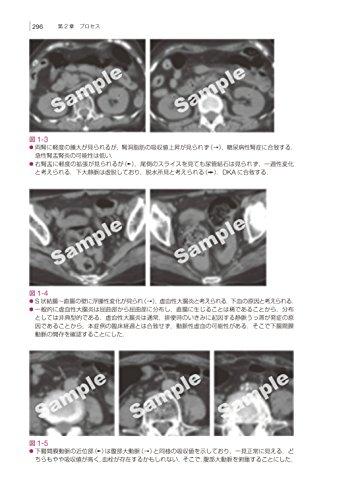Imaging Diagnosis for Diseases and Pathology: Abdominal Emergency Diseases (Otsu Imaging Conference)