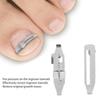 2pcs Ingrown Toenail Corrector Stainless Steel Straightening Pedicure Tool for Paronychia Treatment