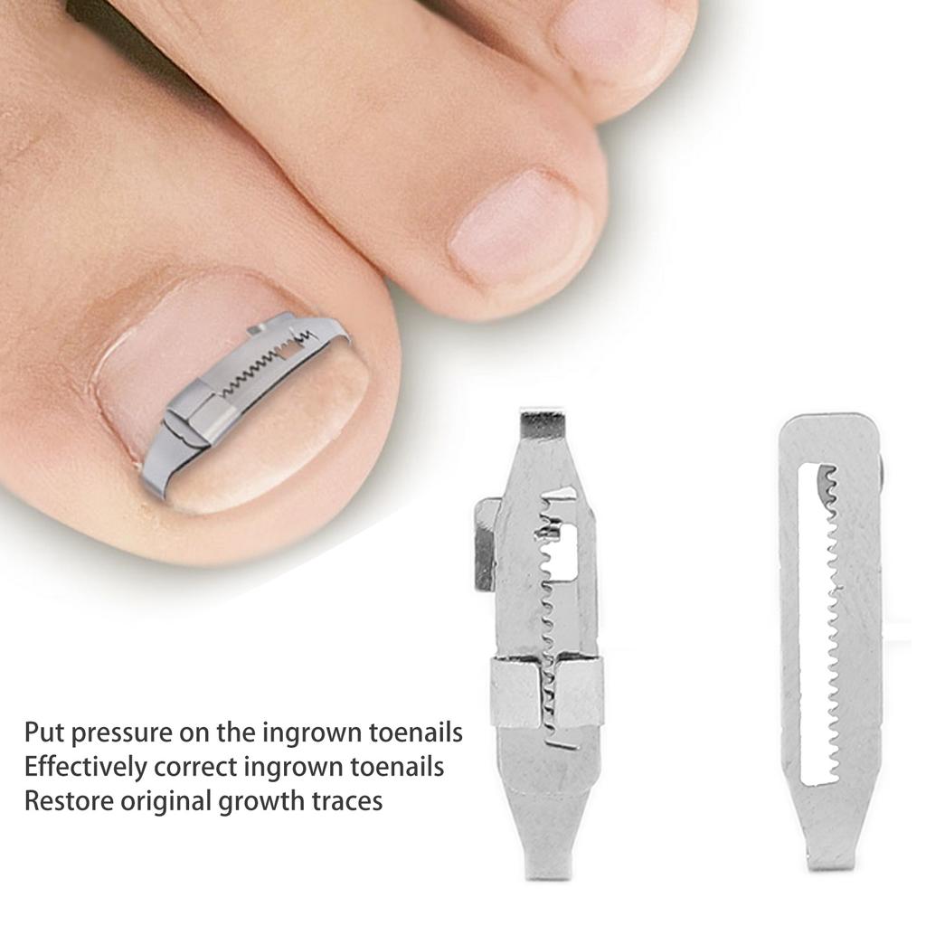 2pcs Ingrown Toenail Corrector Stainless Steel Straightening Pedicure Tool for Paronychia Treatment