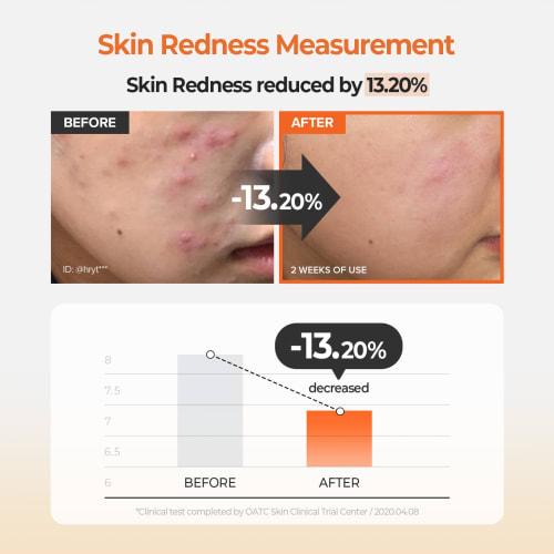 Carrot Carotene Calming Water Pad 250g/60 pieces