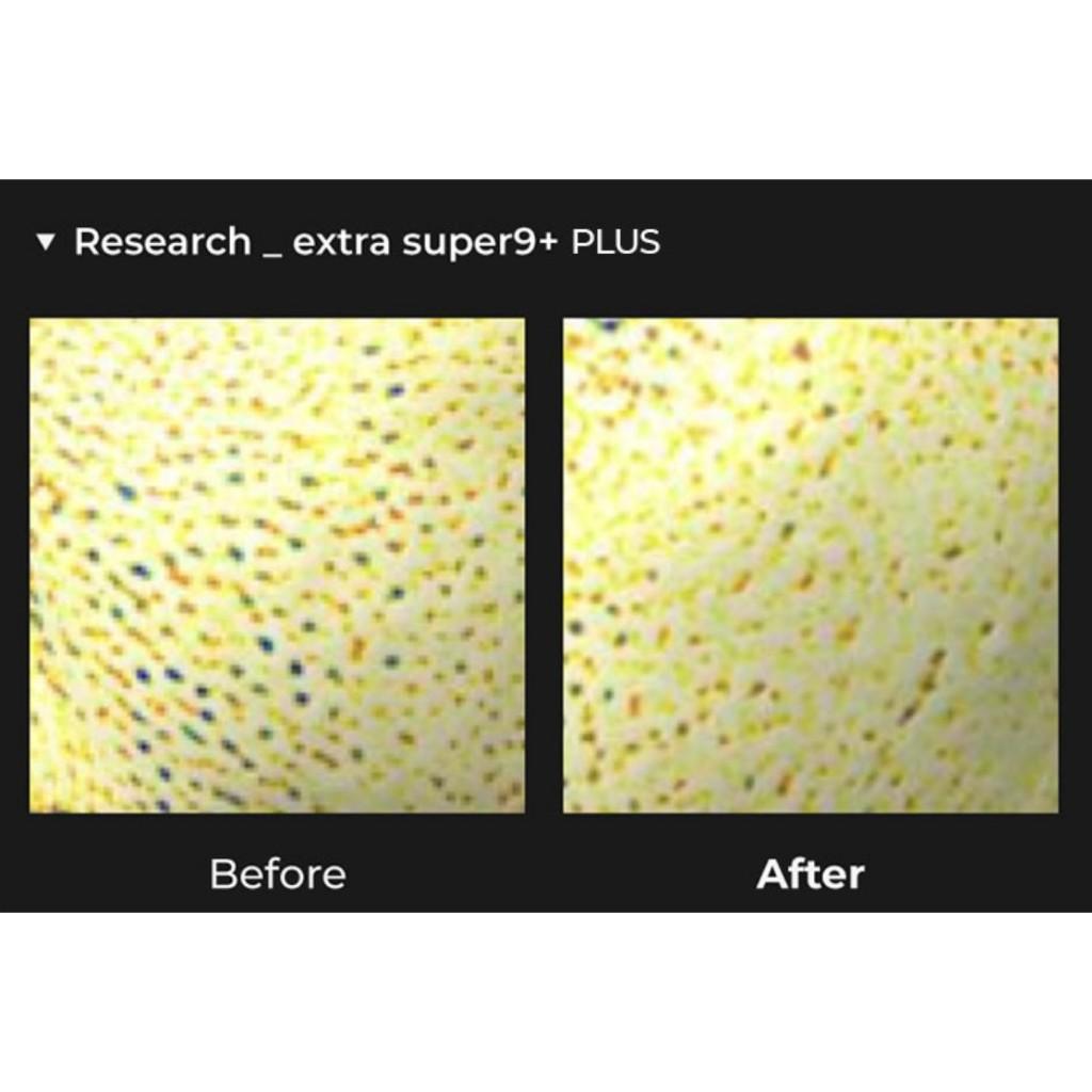 [SET] MEDIPEEL Extra Super 9+ 2.0 Sebum Cleaner & Scraper Set
