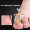 Medical Ingrown Toenail Correction Kit – Professional Nail Care Tool for Treatment and Recovery