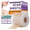 Reusable Silicone Scar Patch and Tape for Surgical Scars