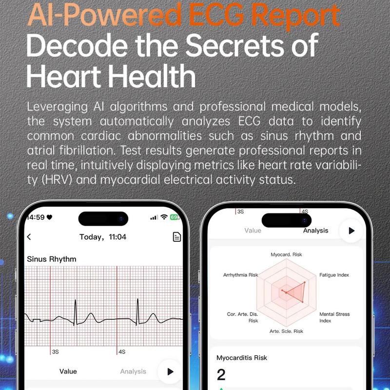2026 New High End Health Smartwatch Blood Lipids ECG+NFC Uric Acid Heart Rate Emotion Detection Heart Health Analysis Blood Oxygen Monitor Watch