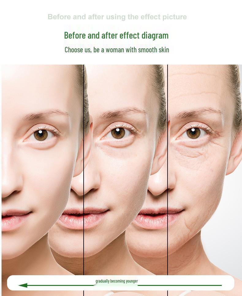 ZGTS Titanium Microneedle Roller for Acne and Skin Care