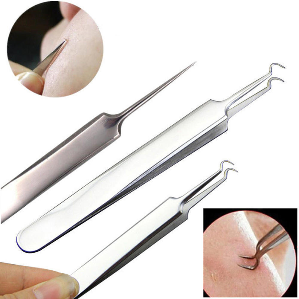 Экстрактор comedone. Пинцет для прыщей. Выдавливатель прыщей и угрей. Пинцет для прыщей. Пинцет игла.