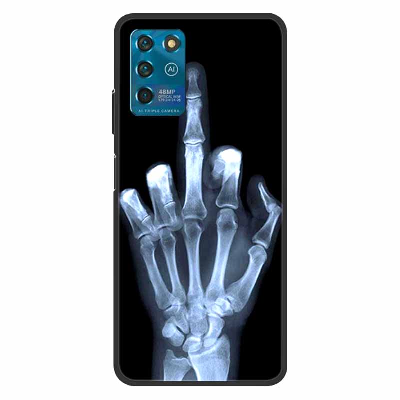 Für ZTE Blade V30 Vita Hülle Abdeckung Weiche Silikon Rückseite für ZTE Blade V30 Vita Hülle Blade V 30 Vita V30Vita 2021 Abdeckung Fundas