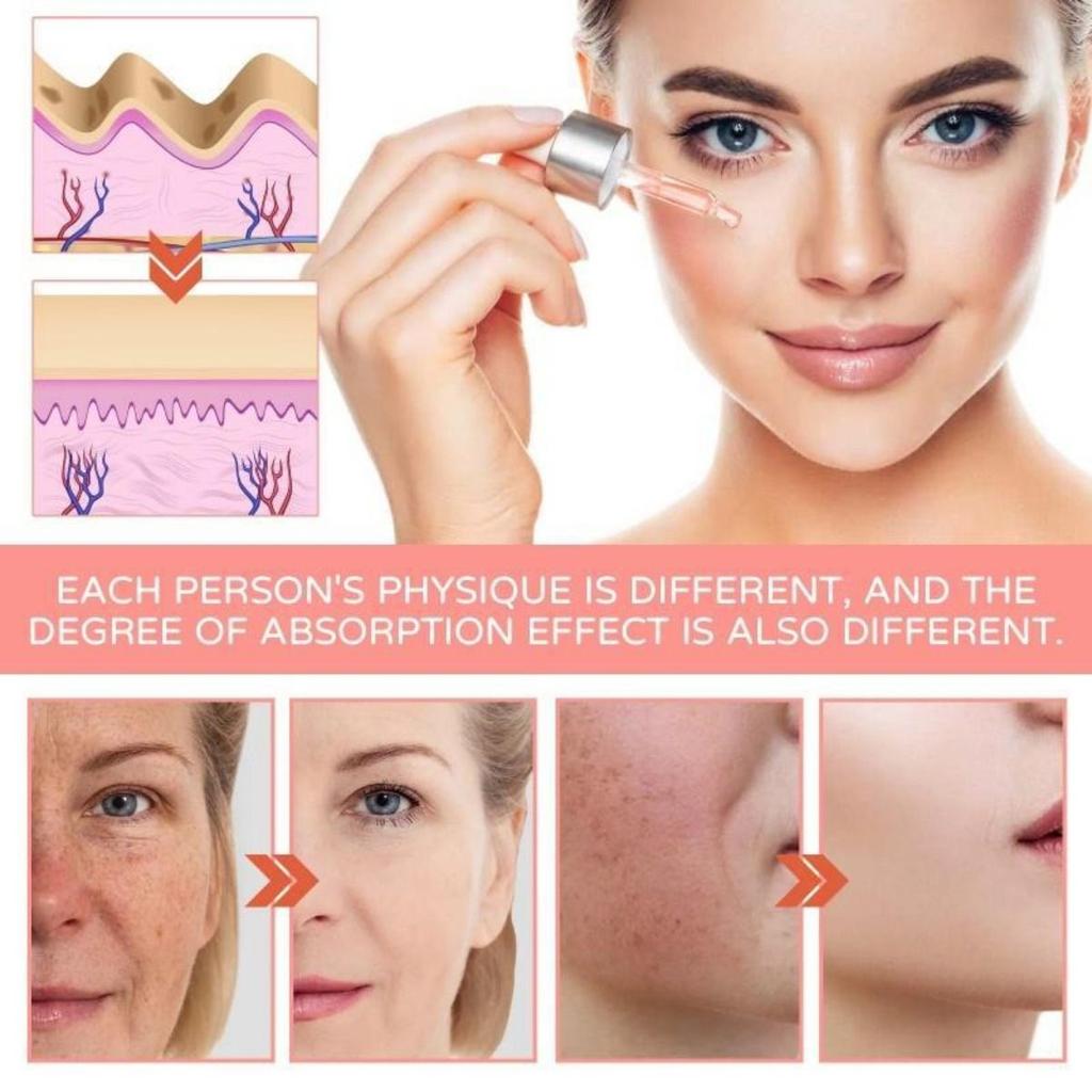 5-in-1 Facial Essence Moisturizes Skin, Anti-wrinkle, Firming, Fades Spots, Acne, Nourishes and Beautifies Skin