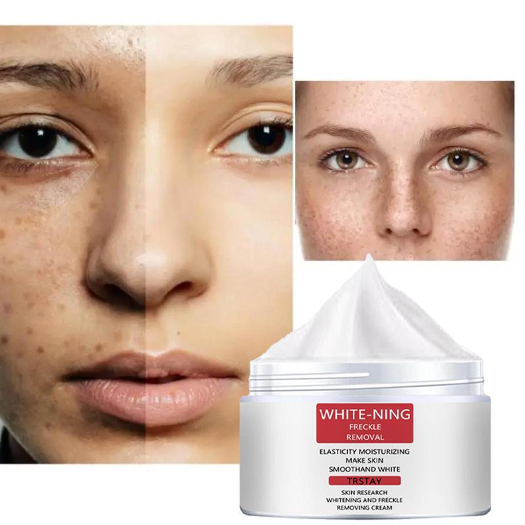 Anti-aging Cream, Rich In Collagen, Prevents Dry Lines, Moisturizes and Moisturizes, Effective Whitening and Freckle Removal Cream