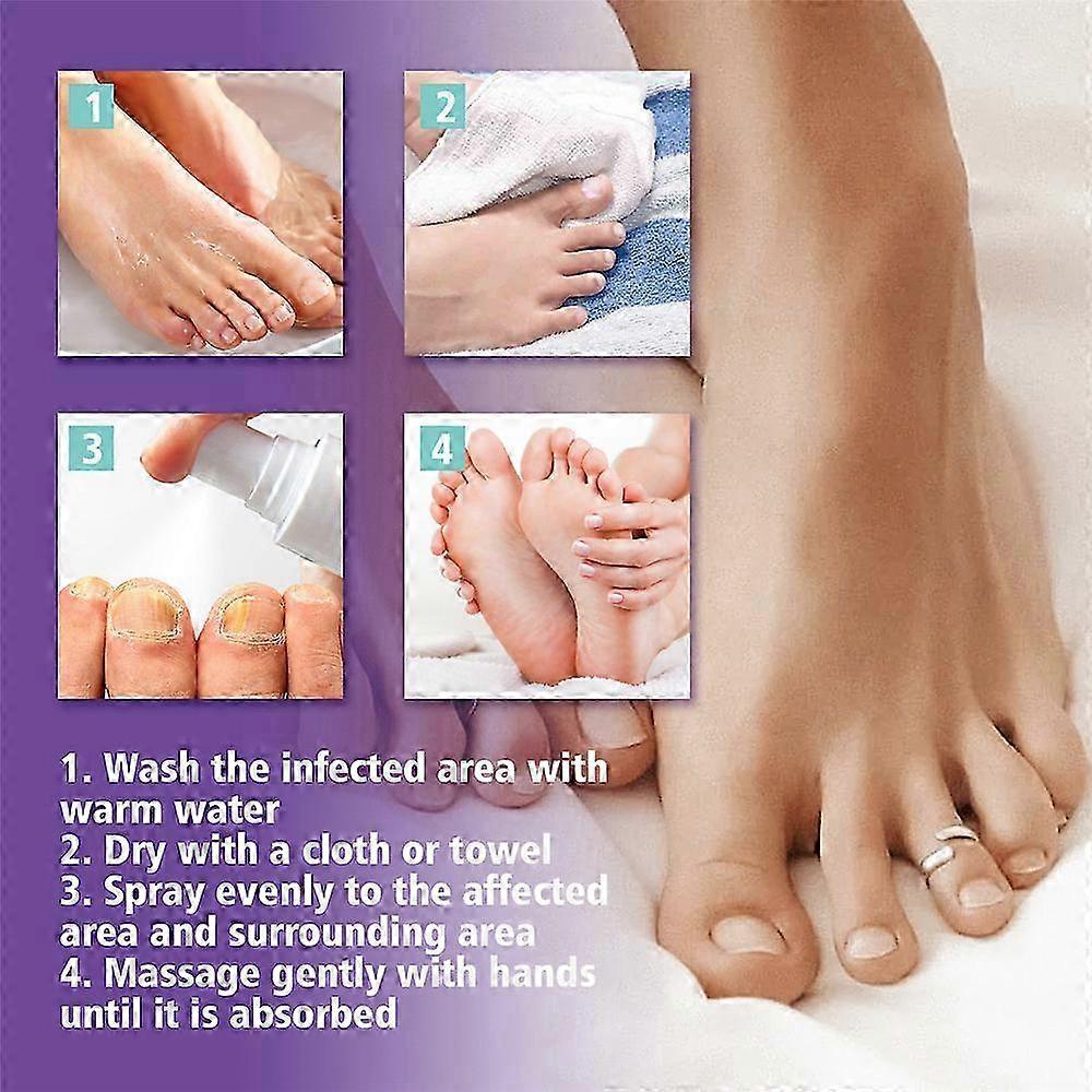 2Pcs Nail Fungus Spray, Toenail Fungus Treatment, Nail Care Solution for Toenail Feet, Fast Itch Relief