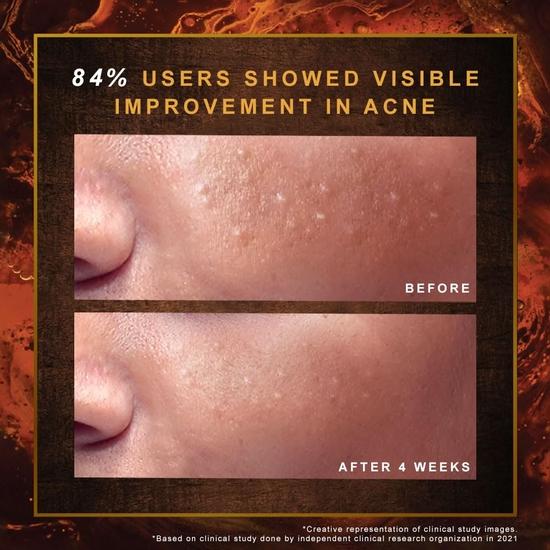 Indulekha Ayurvedic Proprietary Medicine Soap Pack of 3; 100 gm each bar, 300 gms packs