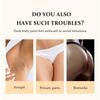 Whitening Cream Private Parts Body Intimate Areas Lightener Dark Parts Butt Intimate Armpit Bri U7Z8