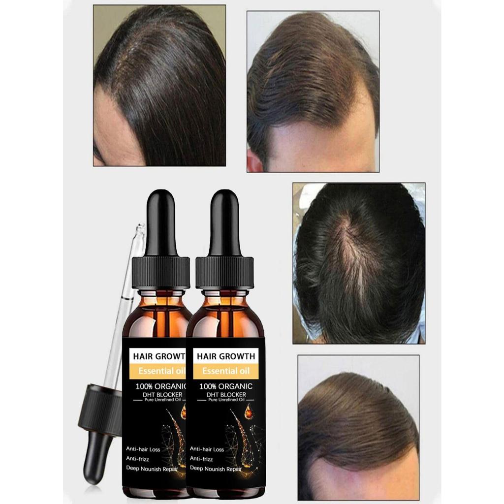 Siyah Hint Yağı Saç Büyümesini Besler Cilt Masajı Uçucu Yağ Kaşları Büyütür Cildin Yaşlanmasını Önler Saç Bakım Ürünleri