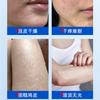 Opeloate Vitamin E Soothing Urea Cream
