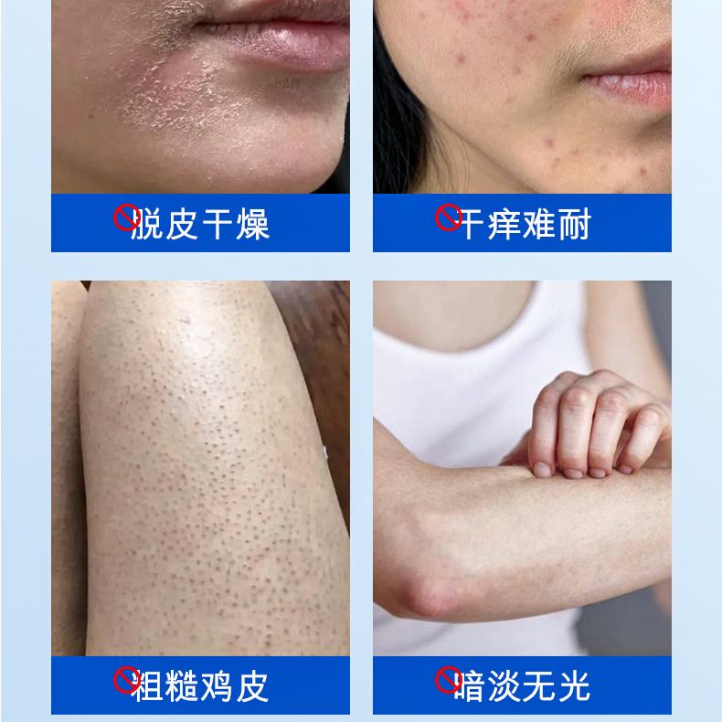 Opeloate Vitamin E Soothing Urea Cream
