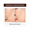 Tosowoong Glutathione Serum 30ml | Potent 20,000ppm Glutathione, Niacinamide & Hyaluronic Acid Blend, Targets Dark Spots, Boosts Skin Elasticity