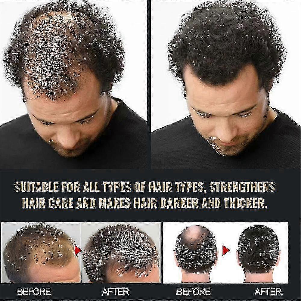 x 3pcs Spartan Root Activator Shampoo, Spartan Hair Loss Shampoo,shampoo Root Activator