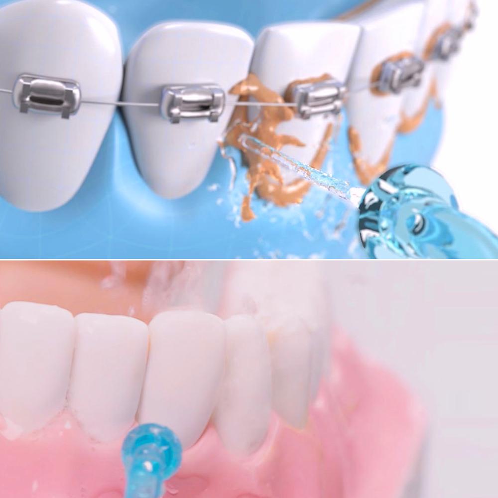 Soocas Oral Irrigator W3 Portable Water Dental Flosser Water Jet Cleaning Tooth Toothpick Mouthpiece Denture Cleaner Teeth Brush