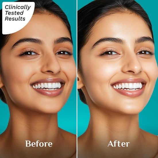 Pilgrim Squalane Niacinamide & Vitamin C Glow Moisturizer for Face | Moisturizer for Dry Skin Hydration  | 50 Gm,Cream