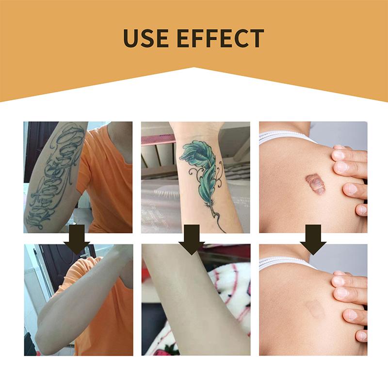 Skin Invisible Concealer Patch Sticker Breathable Tattoo Scar Cover Waterproof Skin-Friendly Silicone Tape Simulation Skin Stick