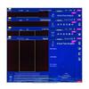 Sirius Core 2S Functional Fitness Assessment System