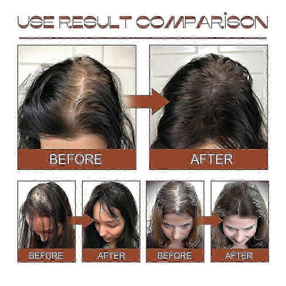Olio di Batana per la Crescita dei Capelli, Olio di Batana Non Raffinato, Per Capelli Più Sani, Spessi e Folti, Olio di Batana Biologico