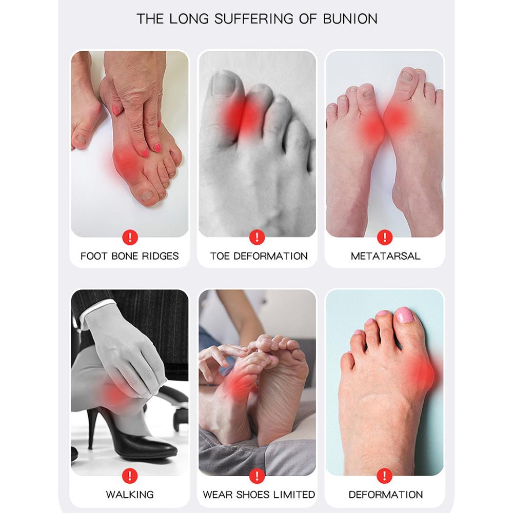 1Pcs Bunion Corrector Relief For Women Men, Big Toe Separator Toe Straightener For Hallux Valgus And Big Toe Joint Pain Relief