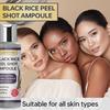 Svart ris-peel-ampulle - Tilfører dyp fuktighet og beroliger tørr eller irritert hud - Styrker hudbarrieren for glattere hud - 100 ml