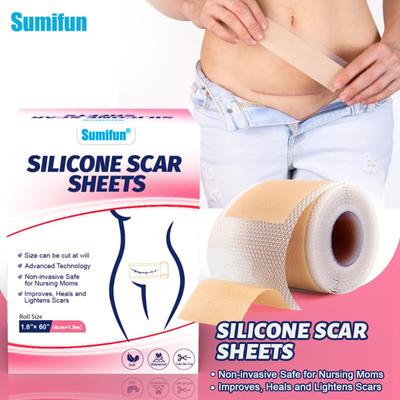 150cm Silicone Gel Scar Patch Scar Roll Patch Small Self-adhesive Scar Patch Invisible Patch Caesarean Section