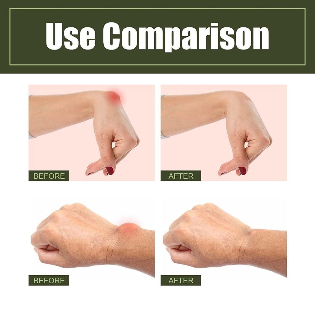 Joint Swelling Pain Relief Spray Natural Herbals Fast Acting Feet Spray for Joint Protection Discomfort Treatment