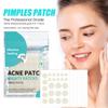 Pimple Patches For Face, Pimple Patches, 3 SIZE,Round Covers, Hyaluronic Sour Complexion Cute Zit Covers (240 Count)