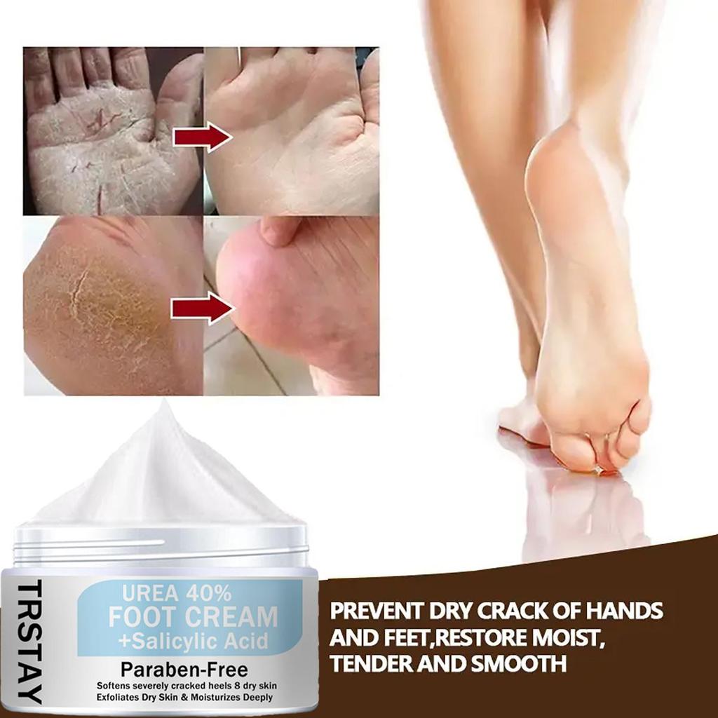 Chapped Feet & Feet Repair Cream er mild og ikke-irriterende, fukter og nærer huden