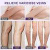 Varicose Veins Cream-Relief Phlebitis Angiitis-Promote Blood Circulation-Repair Skin Elasticity-Suitable For All Skin Types, 20g