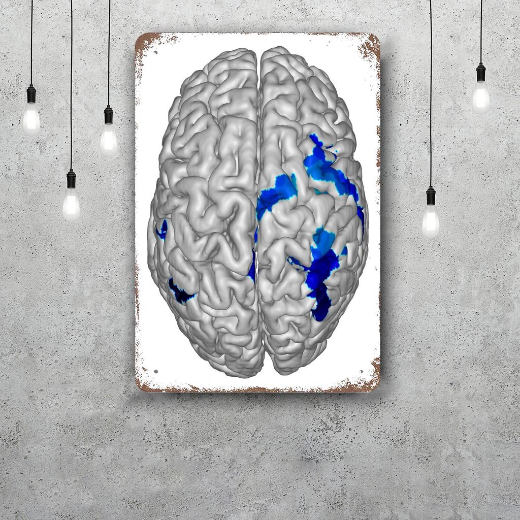 Brain Funny Bar Metal Sign Retro Plaque Vintage Sign Alcohol Drinker Pub Club Man Cave Kitchen Wall Decoration