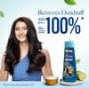 Kesh King Shampooing Ayurvédique Antipelliculaire Pour Femmes | Réduit la Chute des Cheveux | Apaise le Cuir Chevelu Qui Démange | Sans Parabènes Ni Silicones | Paquet de 340 ml
