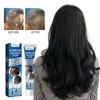 Alopecias Hair Growth Cream Nourish Scalp Improve Hair Loss Prevent Baldness Increase Hair Volume Thicken Hair Regrowth