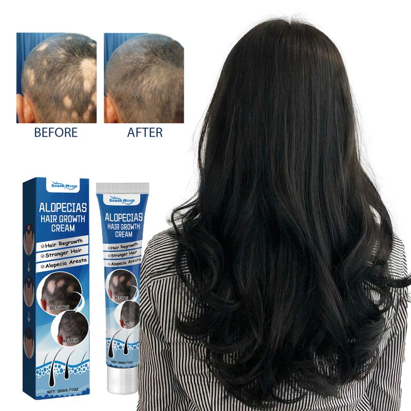 Alopecias Hair Growth Cream Nourish Scalp Improve Hair Loss Prevent Baldness Increase Hair Volume Thicken Hair Regrowth