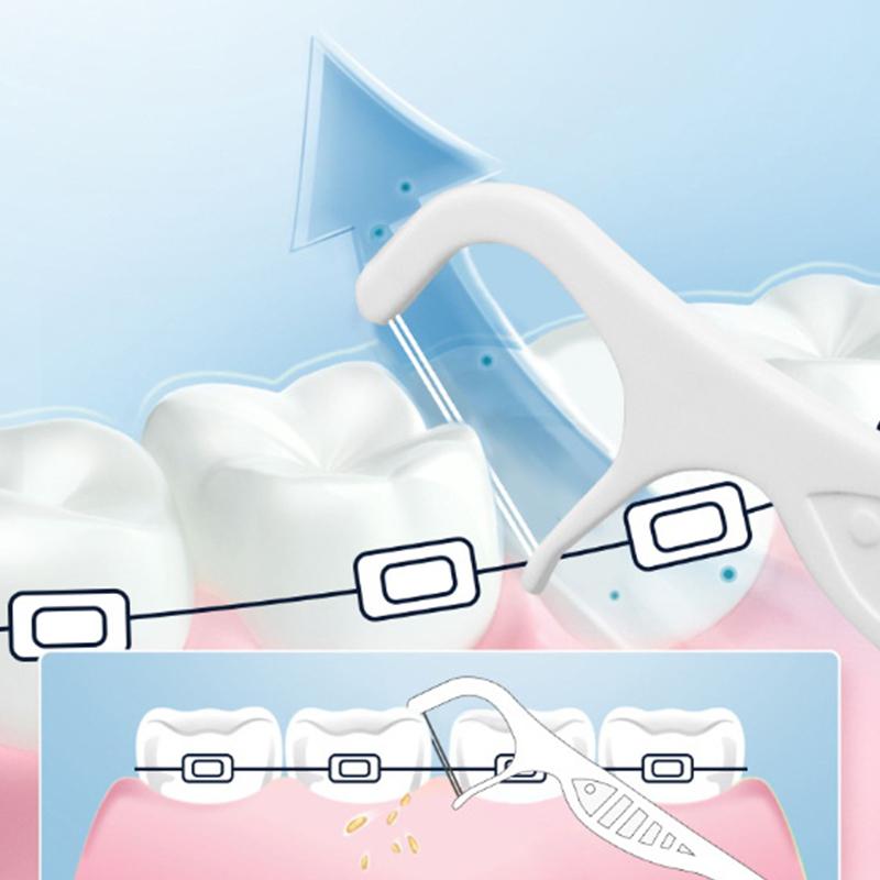 100Pcs/Pack Orthodontic Floss Bar Dental Bracket Steel Wire Slot Dental Floss For Orthodontic Teeth Orthodontic Floss Bar
