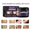 EELHOE Scar Removal Cream Gel Remove Acne Spots Treatment Stretch Marks Burn Surgical Scar Repair Cream Smoothing Whitening Skin Beauty 50g