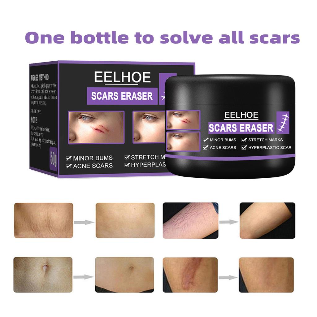 EELHOE Scar Removal Cream Gel Remove Acne Spots Treatment Stretch Marks Burn Surgical Scar Repair Cream Smoothing Whitening Skin Beauty 50g