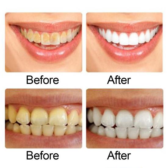 220g Press Type Teeth Whitening Baking Soda Toothpaste Stain Removal Oral Care