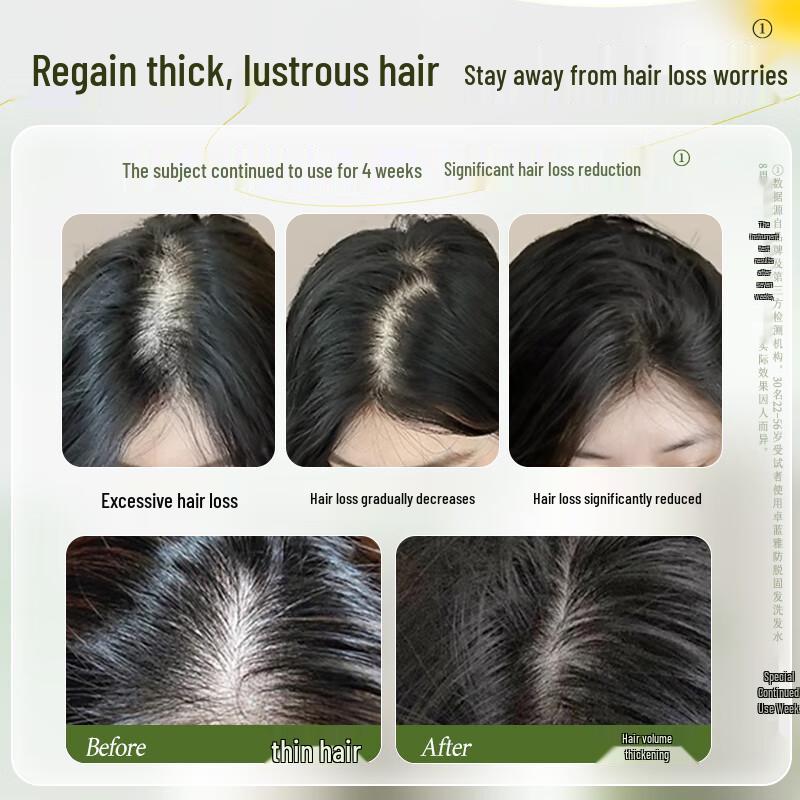 Zuo Lanya Ginger Anti-Hair Loss & Strengthening Shampoo & Conditioner Set