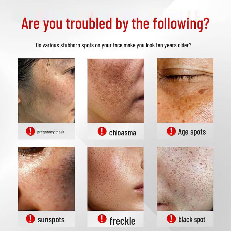 SEEDONVEUR Niacinamide Whitening & Spot Removal Gel Cream