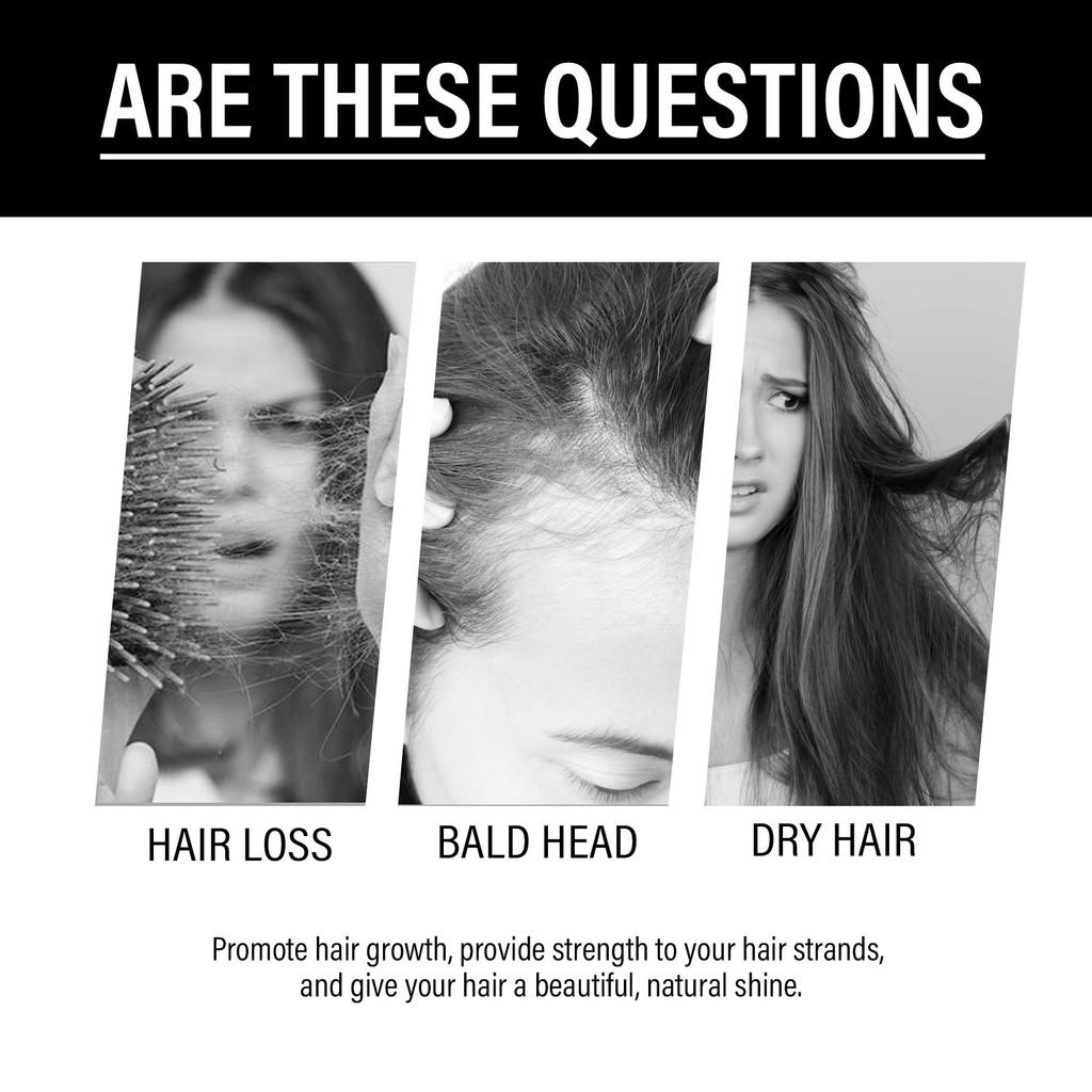 Hoegoa Ginger Infused Hair Essence For Revitalizing Dry Frizzy And Damaged Hair