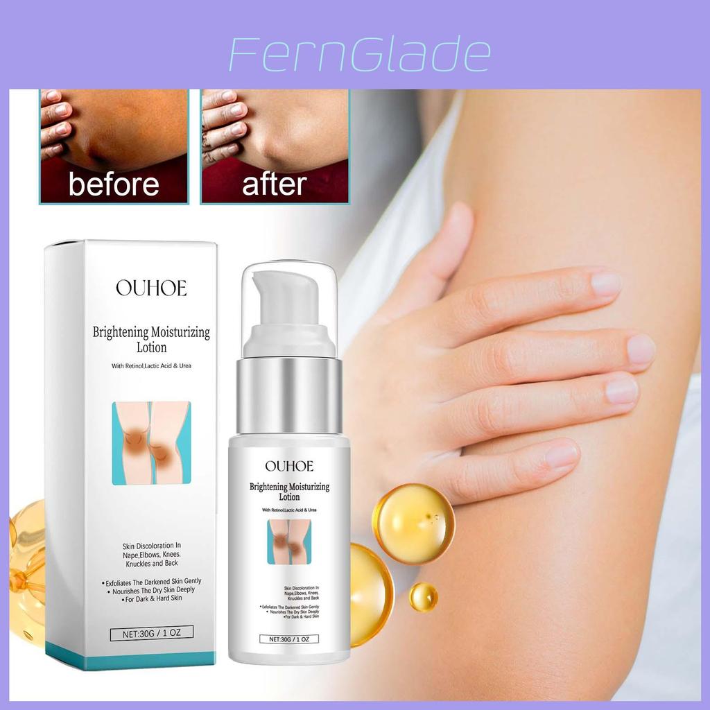 Ouhoe Nourishing Skin Whitening Cream For Underarms And Joints 30g Export Only