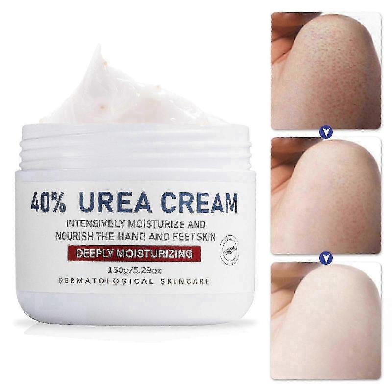 40% Urea Foot Cream 150ml - Deep Moisturizing, Callus Remover, Heals Cracked Heels & Dry Skin, Intensive Repair