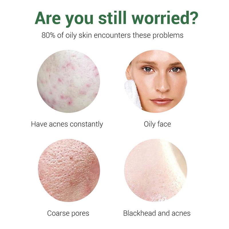 breylee acne treatment facial cleanser